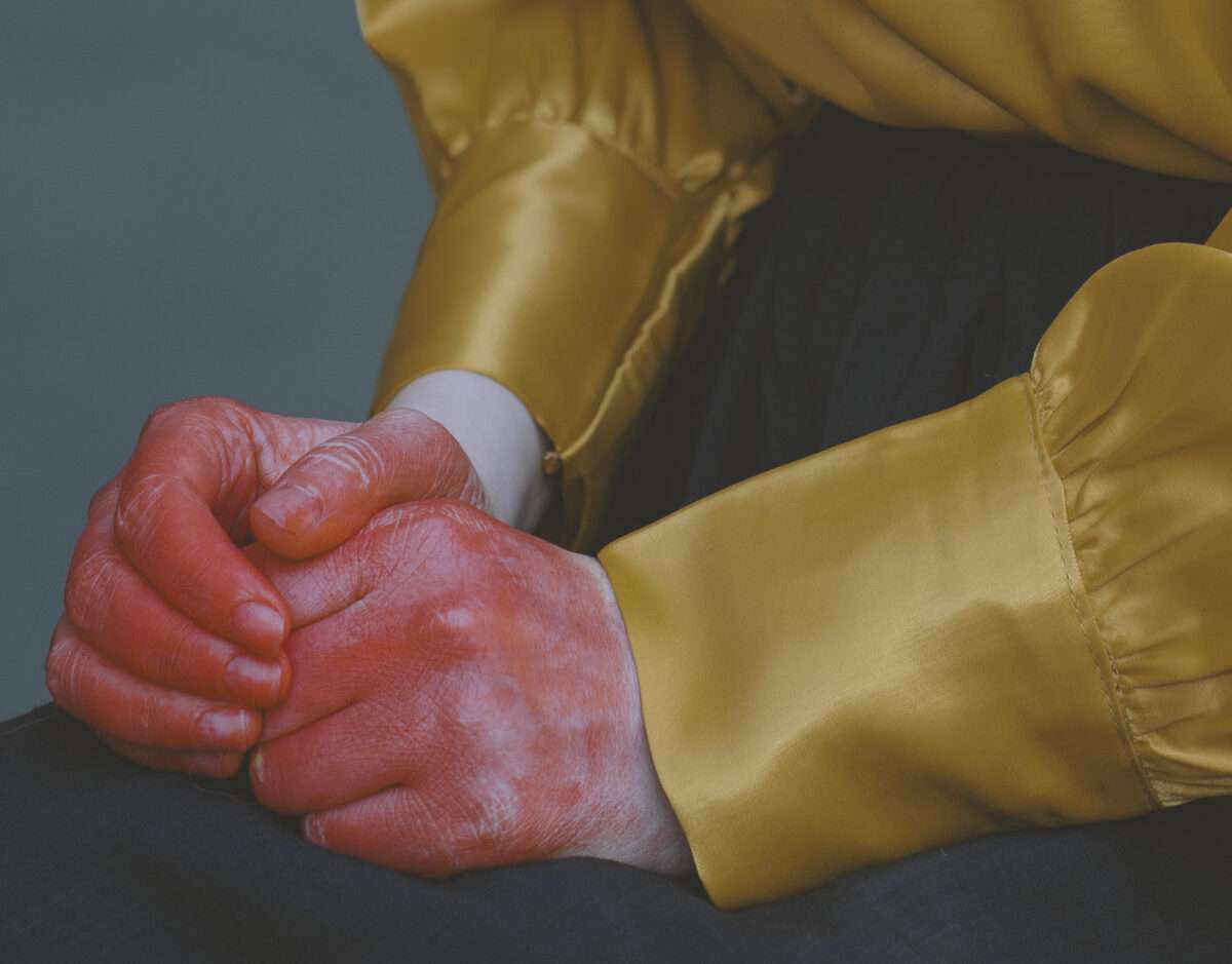 Dieses Detail der Fotografie von Somy Samani mit dem Titel confidential zeigt ihre blutig gefärbten Hände.